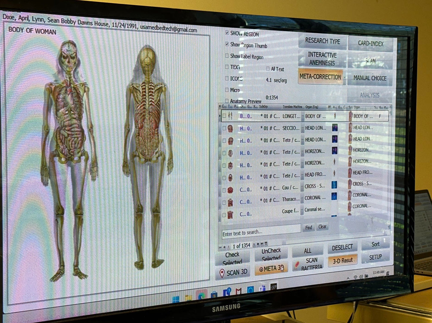 Remote Body Scan Bioscan with Hair Sample Package - USA Med Bed