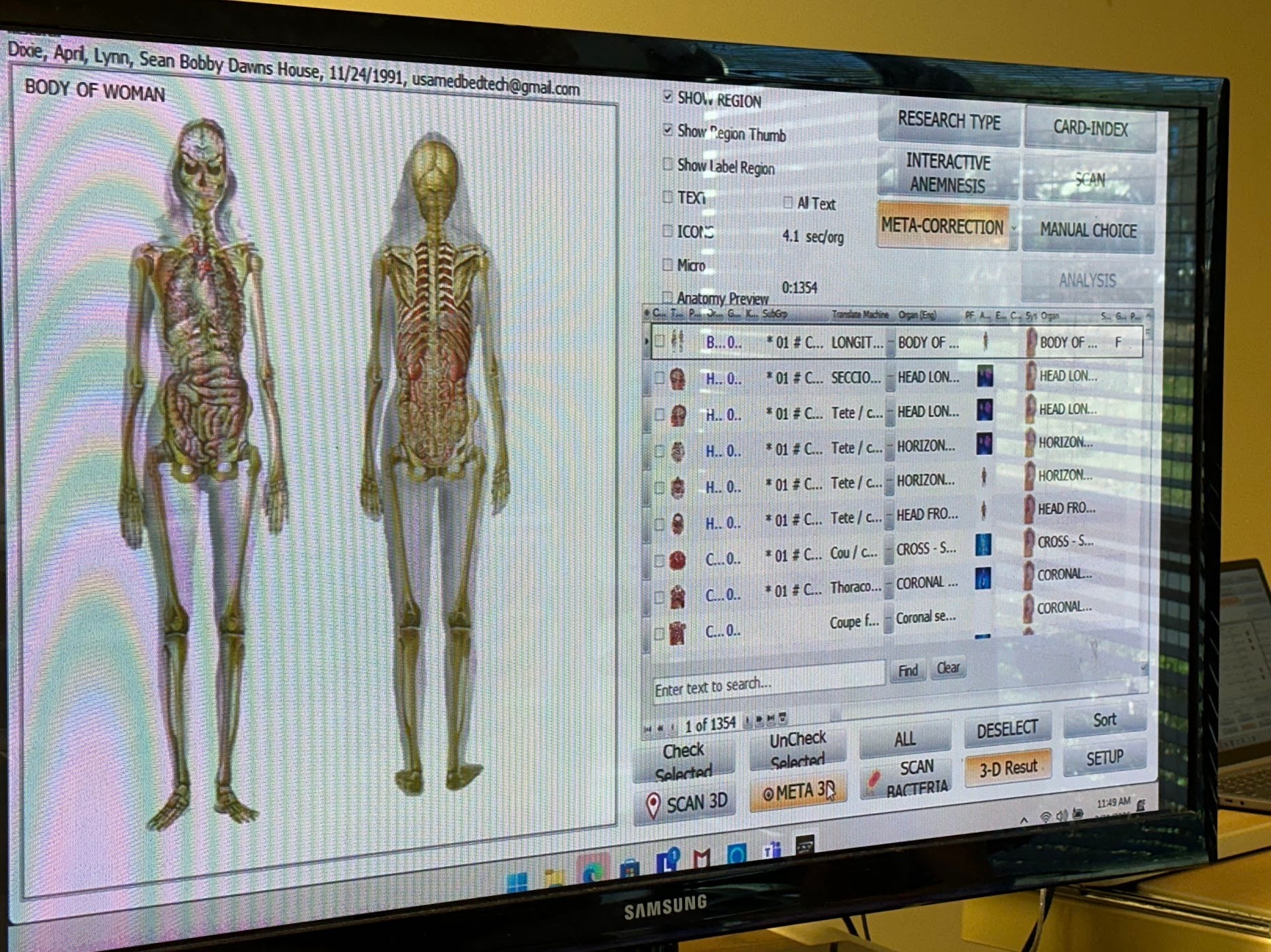 Remote Body Scan Bioscan with Hair Sample Package - USA Med Bed
