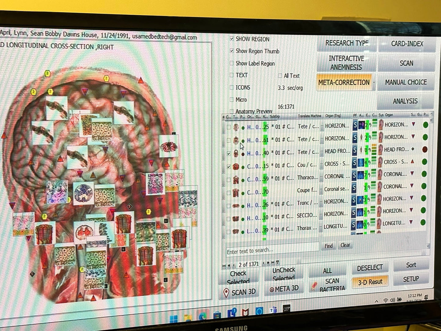 Remote Body Scan Bioscan with Hair Sample Package - USA Med Bed