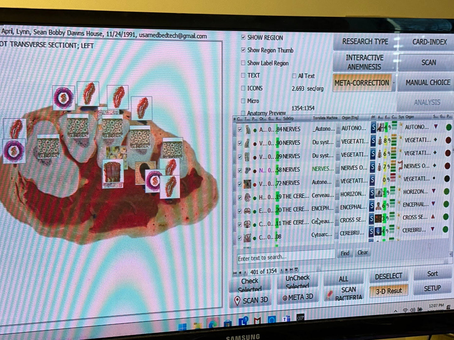 Remote Body Scan Bioscan with Hair Sample Package - USA Med Bed