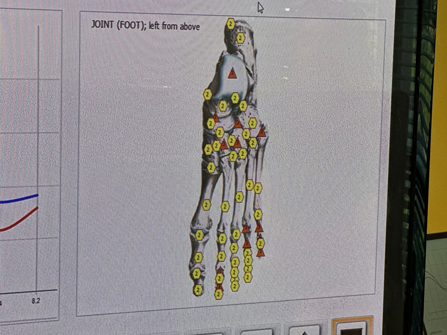 Remote Body Scan Bioscan with Hair Sample Package - USA Med Bed